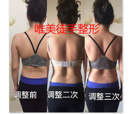 背部塑形有什么好处？