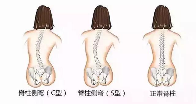 徒手整形知识：在疼痛开始之前，改善你的脊椎